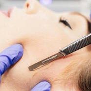 Hair removal Treatment in Scottsdale, AZ | 360 SkinLab